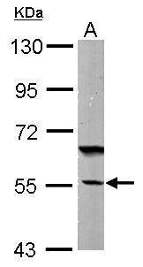 DNAJC7 Rabbit Polyclonal Antibody