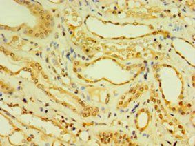 DNAL1 Antibody
