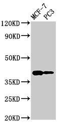 DNase II antibody