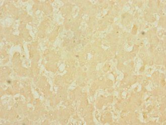 DNASE1L3 Antibody