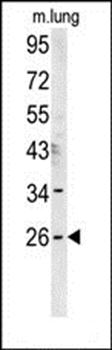 DNJC8 antibody