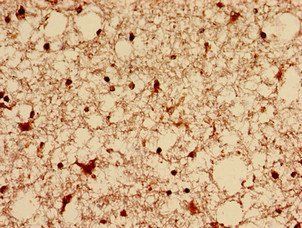 DNM1L Antibody