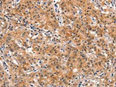 DNM2 Antibody