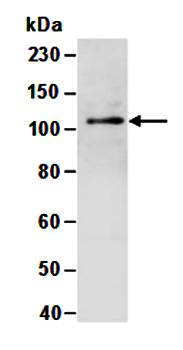 DNMT3A (N2) Antibody, Rabbit Polyclonal