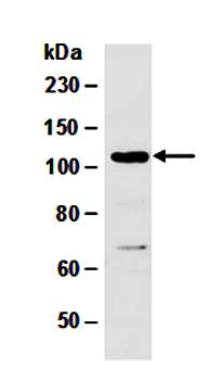 DNMT3A antibody