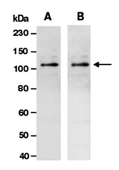 DNMT3A antibody pair