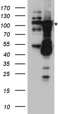 DNMT3B antibody
