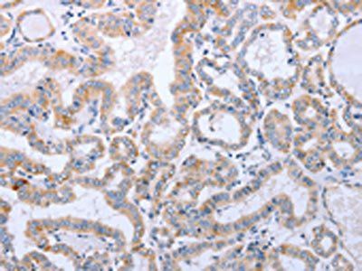 DNMT3L Antibody