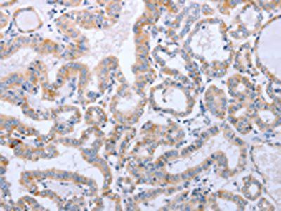 DNMT3L antibody