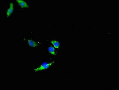 DNMT3L Antibody