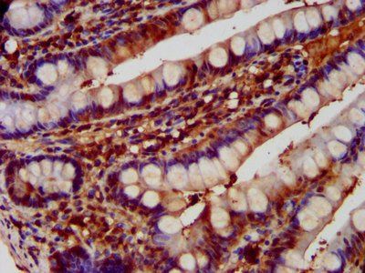DNPEP Antibody