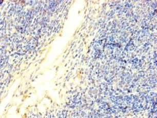DNTT Antibody