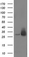 DNTTIP1 antibody
