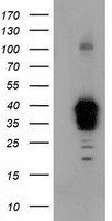 DNTTIP1 Antibody