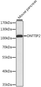 DNTTIP2 antibody