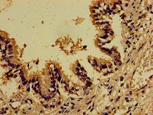 DOCK1 Antibody