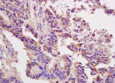 DOCK2 Rabbit Polyclonal Antibody