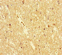DOCK3 Antibody