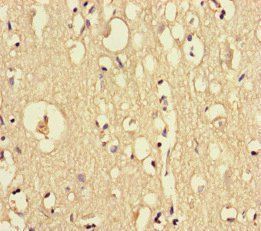 DOCK6 Antibody