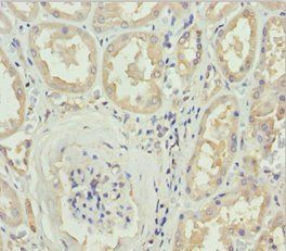 DOCK8 Antibody