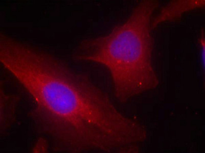 DOK2 (Ab-299) Antibody
