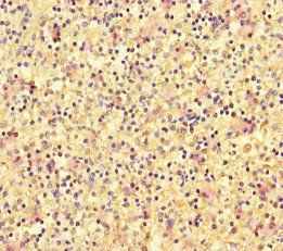 DOK2 Antibody