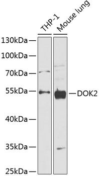 DOK2 antibody