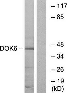 DOK6 Antibody