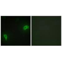 DOK7 Antibody