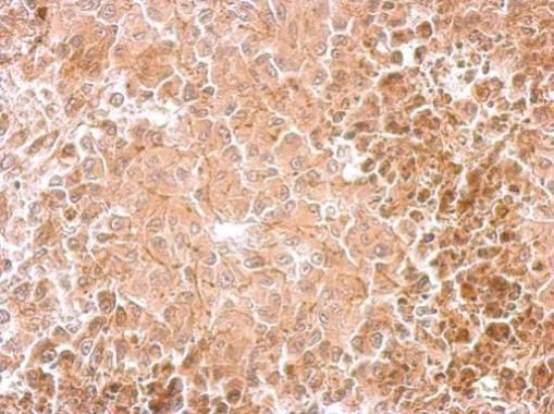 Dopamine beta Hydroxylase antibody
