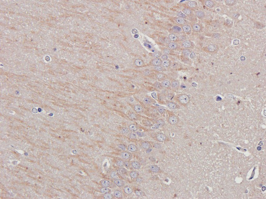 Dopamine D2 receptor antibody