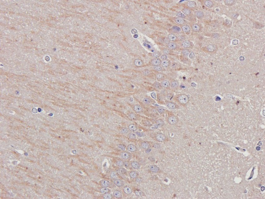 Dopamine D2 receptor antibody