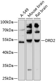 Dopamine D2 receptor antibody