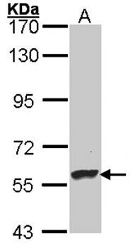 Dopamine beta-Hydroxylase antibody