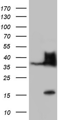 DOT1L Antibody