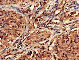 DOT1L Antibody
