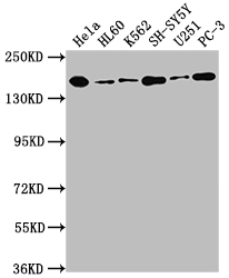 DOT1L Recombinant Monoclonal Antibody