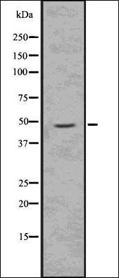 Doublecortin (Phospho-Ser334) antibody