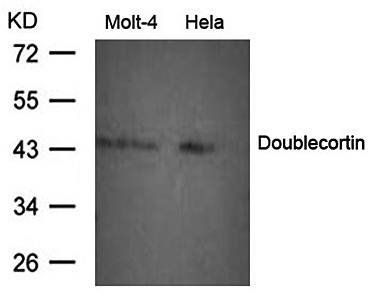 Doublecortin Antibody