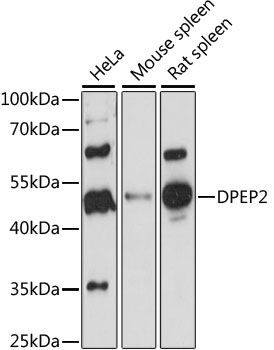 DPEP2 antibody