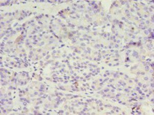 DPH1 antibody