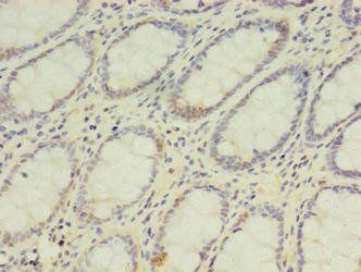DPH2 Antibody