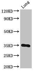 DPM1 Antibody