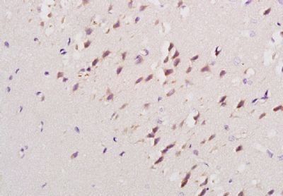 DPP9 Rabbit Polyclonal Antibody