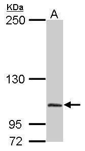 DPRP1 Rabbit Polyclonal Antibody