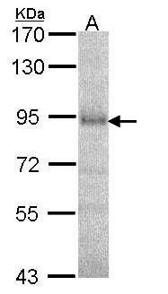 DPRP1 Rabbit Polyclonal Antibody