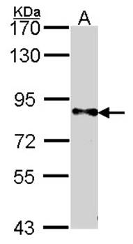 DPYD antibody