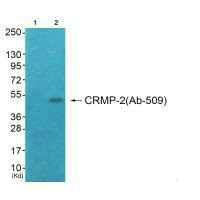 DPYSL2 (Ab-509) antibody