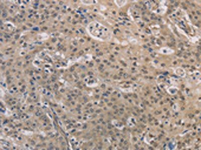 DPYSL3 antibody