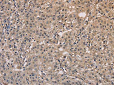 DPYSL3 antibody